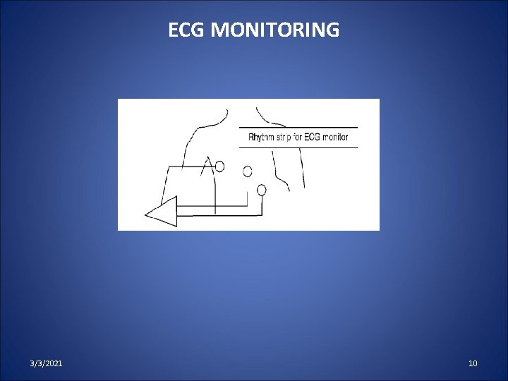 ECG MONITORING 3/3/2021 10 