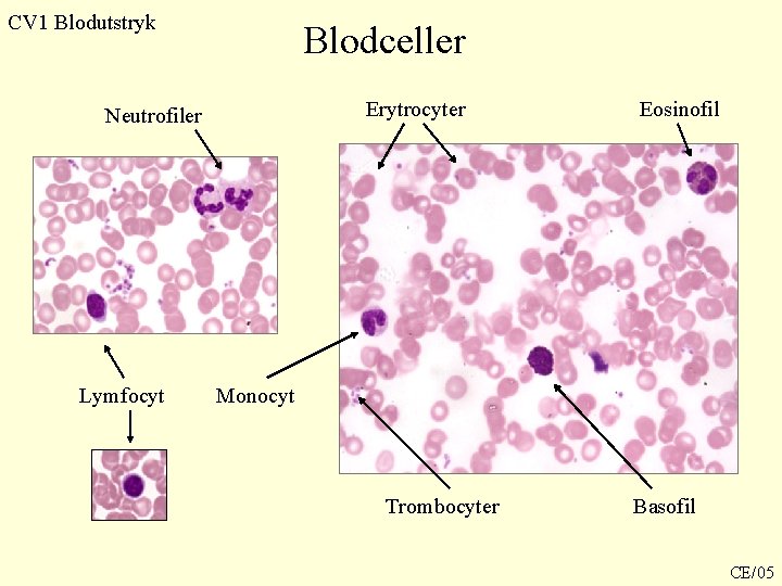 CV 1 Blodutstryk Blodceller Erytrocyter Neutrofiler Lymfocyt Eosinofil Monocyt Trombocyter Basofil CE/05 CV 1 Blodutstryk Blodceller Erytrocyter Neutrofiler Lymfocyt Eosinofil Monocyt Trombocyter Basofil CE/05