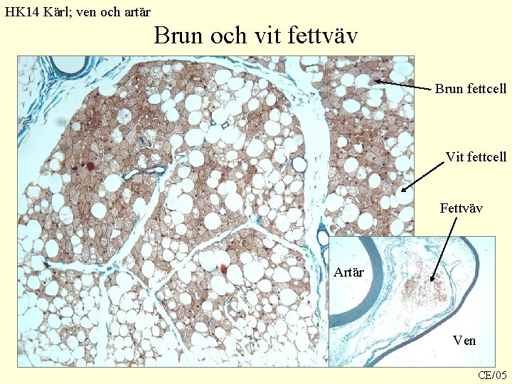 HK 14 Kärl; ven och artär Brun och vit fettväv Brun fettcell Vit fettcell HK 14 Kärl; ven och artär Brun och vit fettväv Brun fettcell Vit fettcell