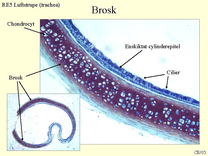 RE 5 Luftstrupe (trachea) Brosk Chondrocyt Enskiktat cylinderepitel Brosk Cilier CE/05 RE 5 Luftstrupe (trachea) Brosk Chondrocyt Enskiktat cylinderepitel Brosk Cilier CE/05