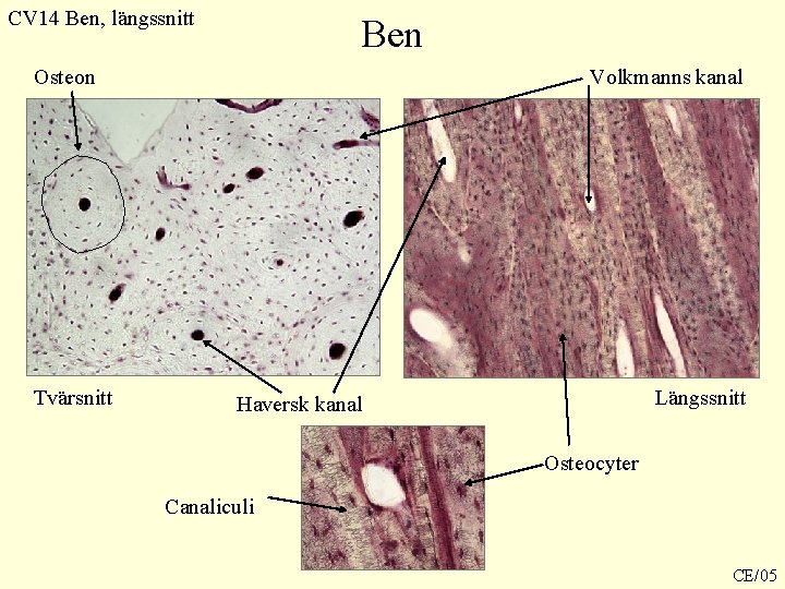 CV 14 Ben, längssnitt Ben Osteon Tvärsnitt Volkmanns kanal Längssnitt Haversk kanal Osteocyter Canaliculi CV 14 Ben, längssnitt Ben Osteon Tvärsnitt Volkmanns kanal Längssnitt Haversk kanal Osteocyter Canaliculi