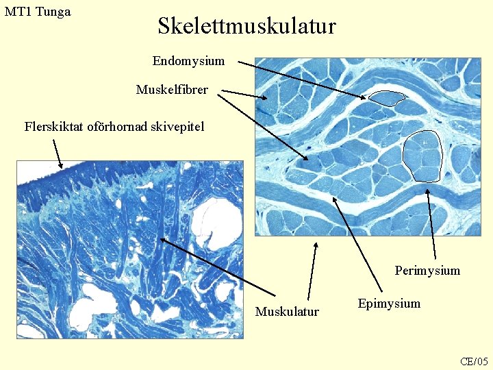MT 1 Tunga Skelettmuskulatur Endomysium Muskelfibrer Flerskiktat oförhornad skivepitel Perimysium Muskulatur Epimysium CE/05 MT 1 Tunga Skelettmuskulatur Endomysium Muskelfibrer Flerskiktat oförhornad skivepitel Perimysium Muskulatur Epimysium CE/05