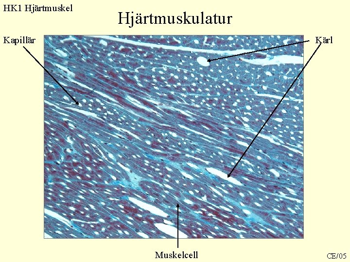 HK 1 Hjärtmuskel Hjärtmuskulatur Kapillär Kärl Muskelcell CE/05 HK 1 Hjärtmuskel Hjärtmuskulatur Kapillär Kärl Muskelcell CE/05
