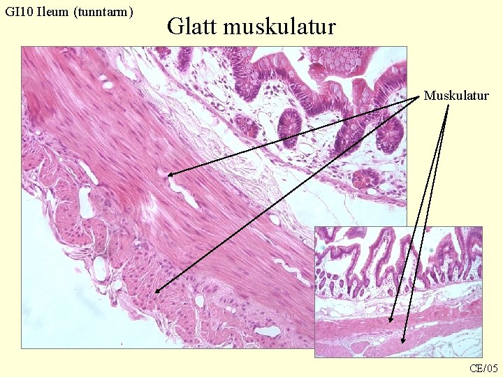 GI 10 Ileum (tunntarm) Glatt muskulatur Muskulatur CE/05 GI 10 Ileum (tunntarm) Glatt muskulatur Muskulatur CE/05
