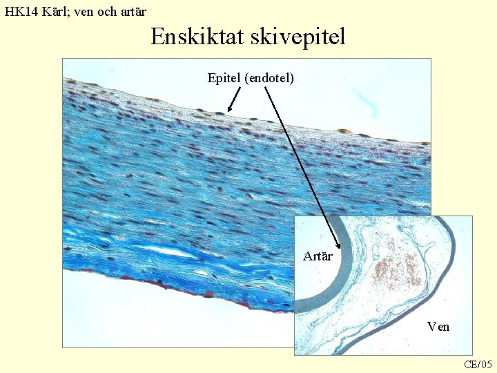 HK 14 Kärl; ven och artär Enskiktat skivepitel Epitel (endotel) Artär Ven CE/05 HK 14 Kärl; ven och artär Enskiktat skivepitel Epitel (endotel) Artär Ven CE/05
