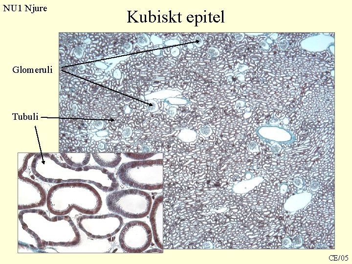 NU 1 Njure Kubiskt epitel Glomeruli Tubuli CE/05 NU 1 Njure Kubiskt epitel Glomeruli Tubuli CE/05