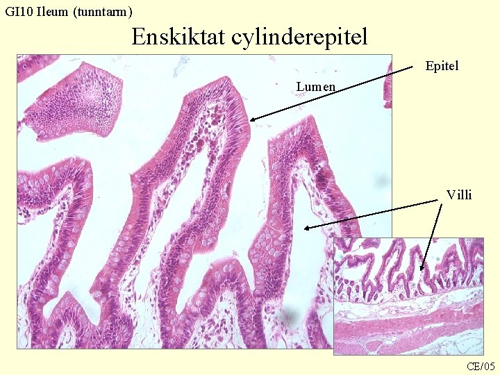GI 10 Ileum (tunntarm) Enskiktat cylinderepitel Epitel Lumen Villi CE/05 GI 10 Ileum (tunntarm) Enskiktat cylinderepitel Epitel Lumen Villi CE/05