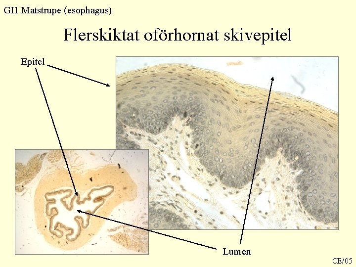 GI 1 Matstrupe (esophagus) Flerskiktat oförhornat skivepitel Epitel Lumen CE/05 GI 1 Matstrupe (esophagus) Flerskiktat oförhornat skivepitel Epitel Lumen CE/05