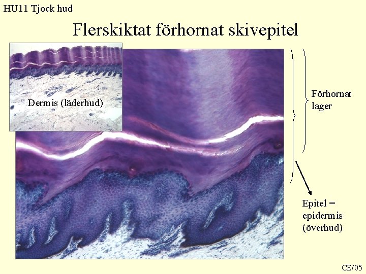 HU 11 Tjock hud Flerskiktat förhornat skivepitel Dermis (läderhud) Förhornat lager Epitel = epidermis HU 11 Tjock hud Flerskiktat förhornat skivepitel Dermis (läderhud) Förhornat lager Epitel = epidermis