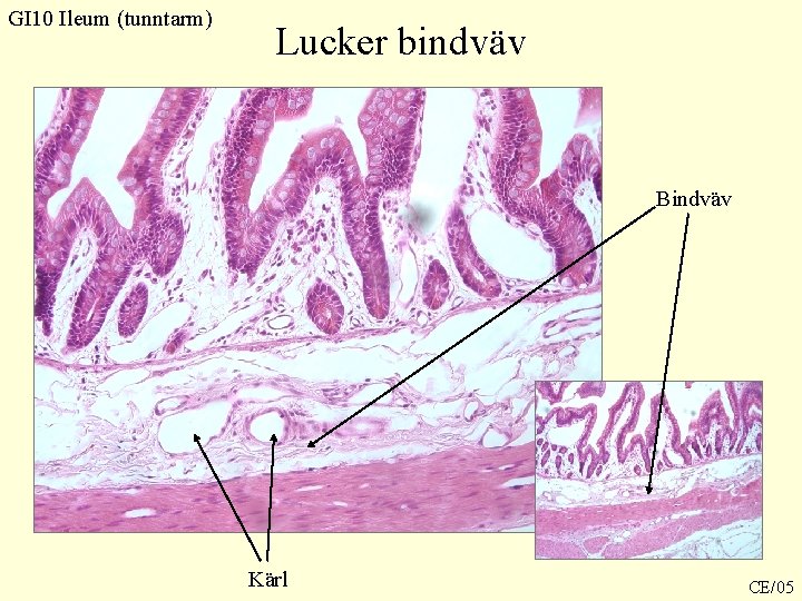 GI 10 Ileum (tunntarm) Lucker bindväv Bindväv Kärl CE/05 GI 10 Ileum (tunntarm) Lucker bindväv Bindväv Kärl CE/05
