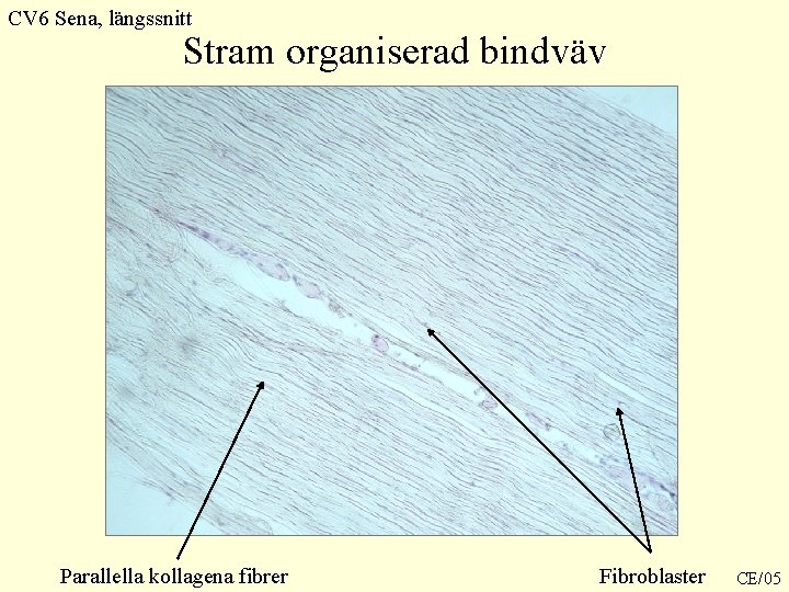 CV 6 Sena, längssnitt Stram organiserad bindväv Parallella kollagena fibrer Fibroblaster CE/05 CV 6 Sena, längssnitt Stram organiserad bindväv Parallella kollagena fibrer Fibroblaster CE/05