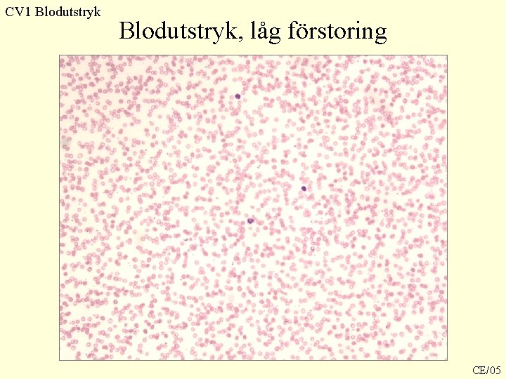 CV 1 Blodutstryk, låg förstoring CE/05 CV 1 Blodutstryk, låg förstoring CE/05