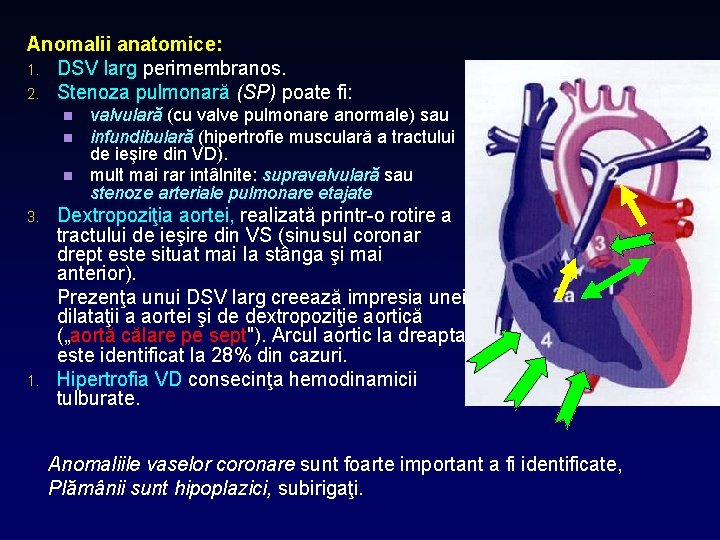 Anomalii anatomice: 1. DSV larg perimembranos. 2. Stenoza pulmonară (SP) poate fi: n n