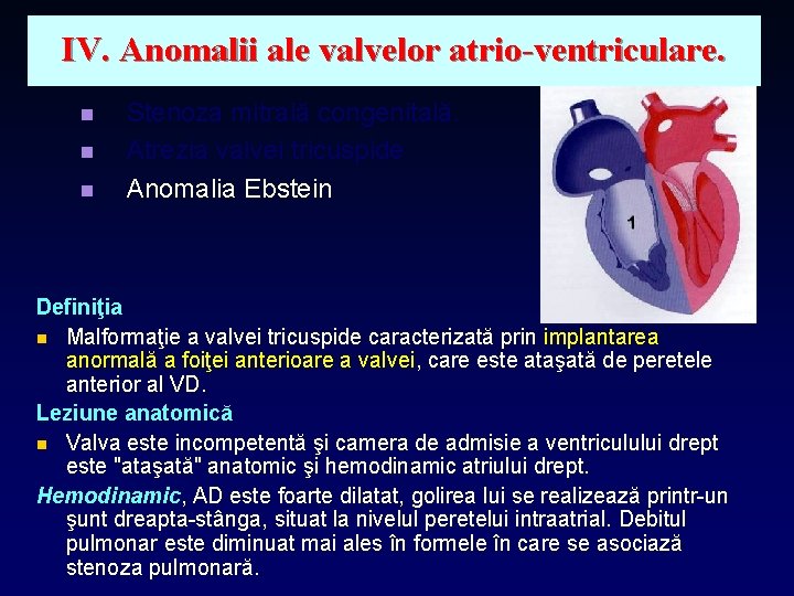 IV. Anomalii ale valvelor atrio-ventriculare. n n n Stenoza mitrală congenitală. Atrezia valvei tricuspide