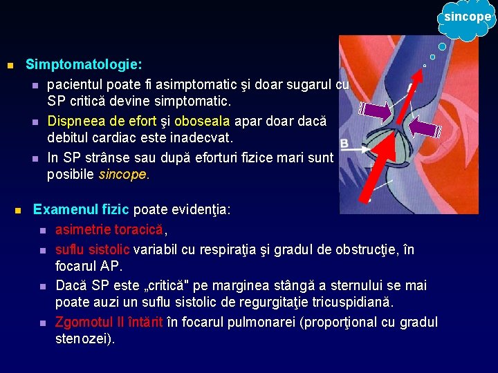 sincope n n Simptomatologie: n pacientul poate fi asimptomatic şi doar sugarul cu SP