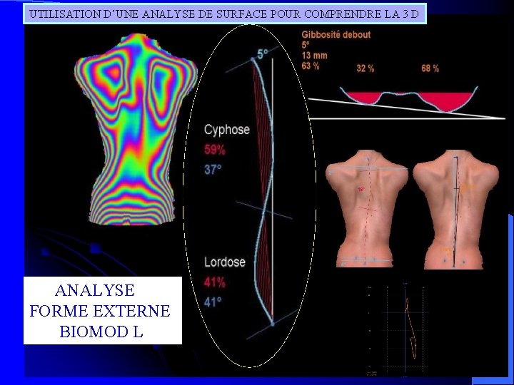 UTILISATION D’UNE ANALYSE DE SURFACE POUR COMPRENDRE LA 3 D ANALYSE FORME EXTERNE BIOMOD