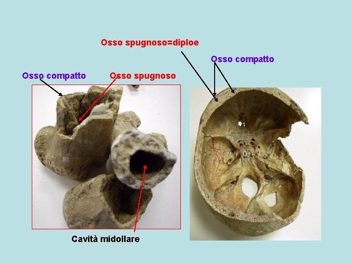 Osso spugnoso=diploe Osso compatto Osso spugnoso Cavità midollare 