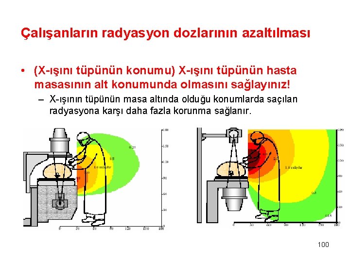Çalışanların radyasyon dozlarının azaltılması • (X-ışını tüpünün konumu) X-ışını tüpünün hasta masasının alt konumunda