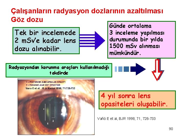 Çalışanların radyasyon dozlarının azaltılması Göz dozu Günde ortalama 3 inceleme yapılması durumunda bir yılda