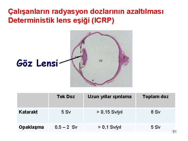 Çalışanların radyasyon dozlarının azaltılması Deterministik lens eşiği (ICRP) Göz Lensi Katarakt Opaklaşma Tek Doz