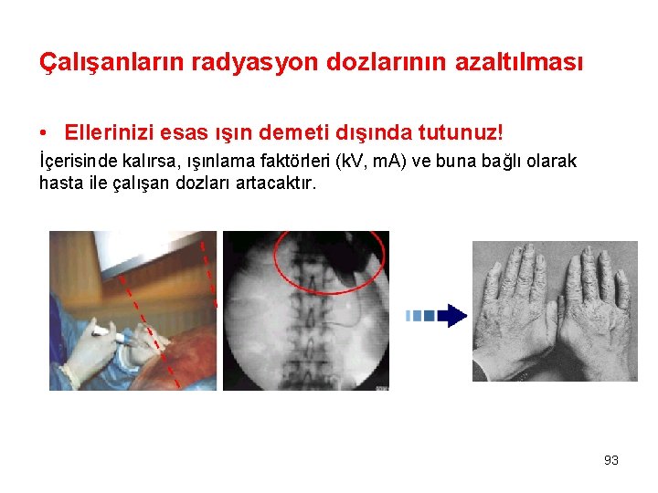 Çalışanların radyasyon dozlarının azaltılması • Ellerinizi esas ışın demeti dışında tutunuz! İçerisinde kalırsa, ışınlama