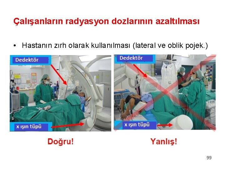 Çalışanların radyasyon dozlarının azaltılması • Hastanın zırh olarak kullanılması (lateral ve oblik pojek. )