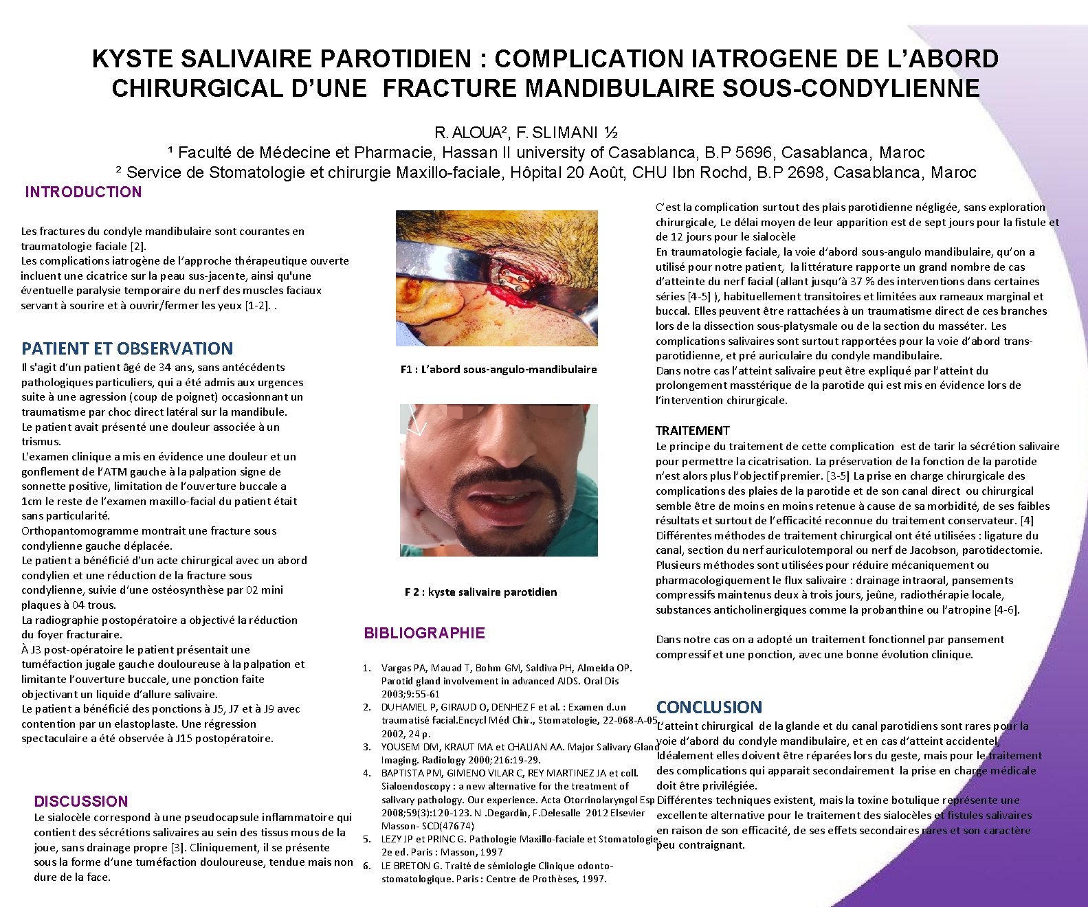 KYSTE SALIVAIRE PAROTIDIEN : COMPLICATION IATROGENE DE L’ABORD CHIRURGICAL D’UNE FRACTURE MANDIBULAIRE SOUS-CONDYLIENNE R.