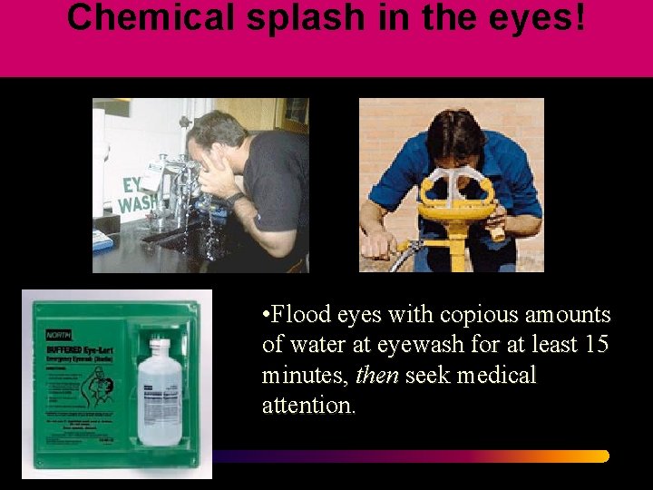 Chemical splash in the eyes! • Flood eyes with copious amounts of water at