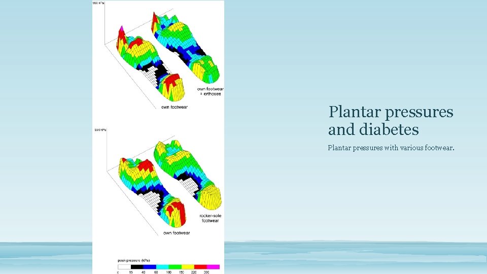 Plantar pressures and diabetes Plantar pressures with various footwear. 