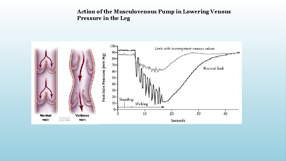 Action of the Musculovenous Pump in Lowering Venous Pressure in the Leg 