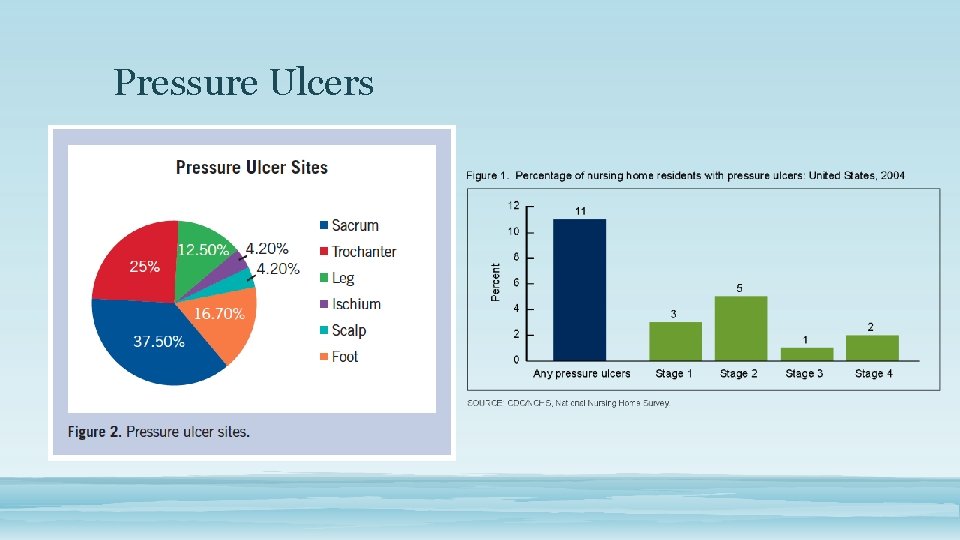 Pressure Ulcers 