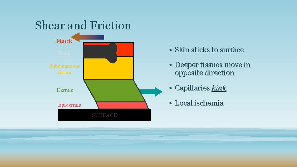 Shear and Friction Muscle • Skin sticks to surface Bone • Deeper tissues move