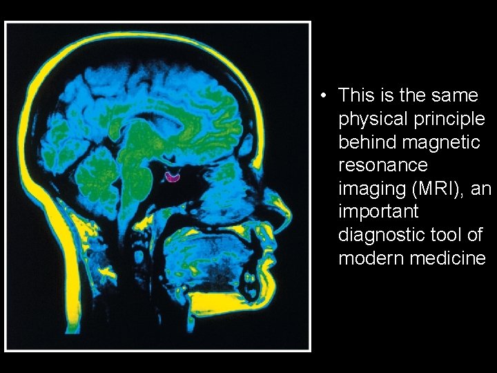  • This is the same physical principle behind magnetic resonance imaging (MRI), an