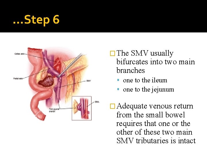 …Step 6 � The SMV usually bifurcates into two main branches one to the