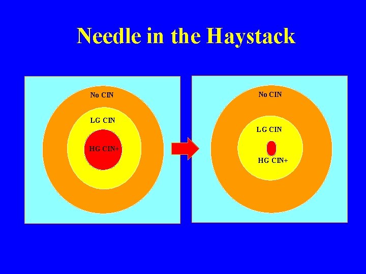 Needle in the Haystack No CIN LG CIN II HG CIN+ 