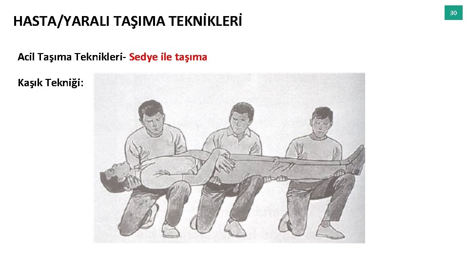 HASTA/YARALI TAŞIMA TEKNİKLERİ Acil Taşıma Teknikleri- Sedye ile taşıma Kaşık Tekniği: 30 