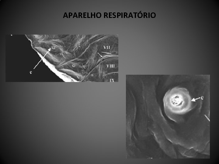 APARELHO RESPIRATÓRIO 