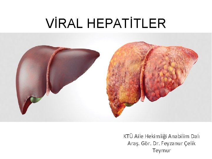 VİRAL HEPATİTLER KTÜ Aile Hekimliği Anabilim Dalı Araş. Gör. Dr. Feyzanur Çelik Teymur 