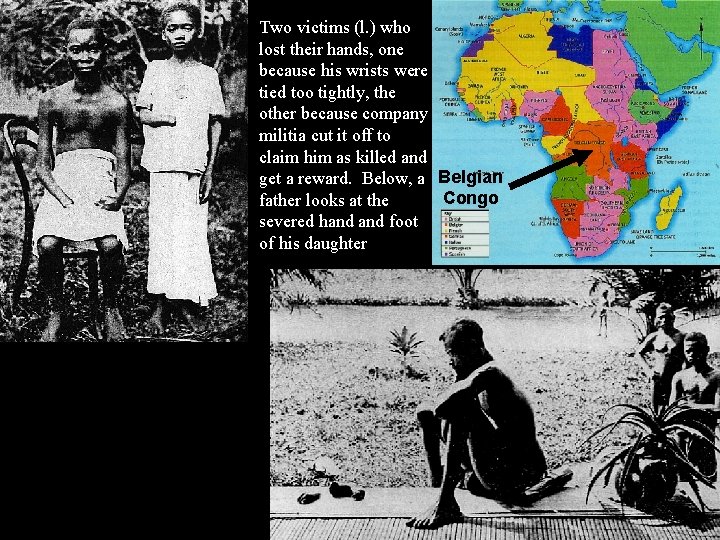 Two victims (l. ) who lost their hands, one because his wrists were tied