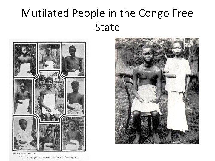 Mutilated People in the Congo Free State 