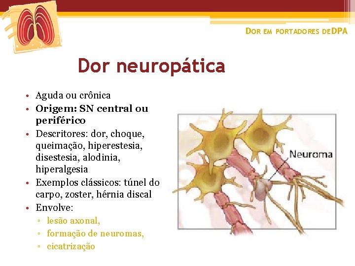 DOR EM PORTADORES DE DPA Dor neuropática • Aguda ou crônica • Origem: SN