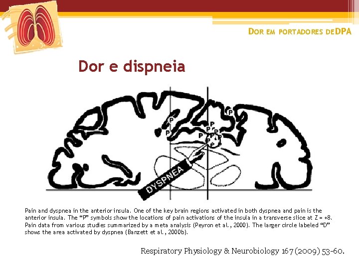 DOR EM PORTADORES DE DPA Dor e dispneia Pain and dyspnea in the anterior