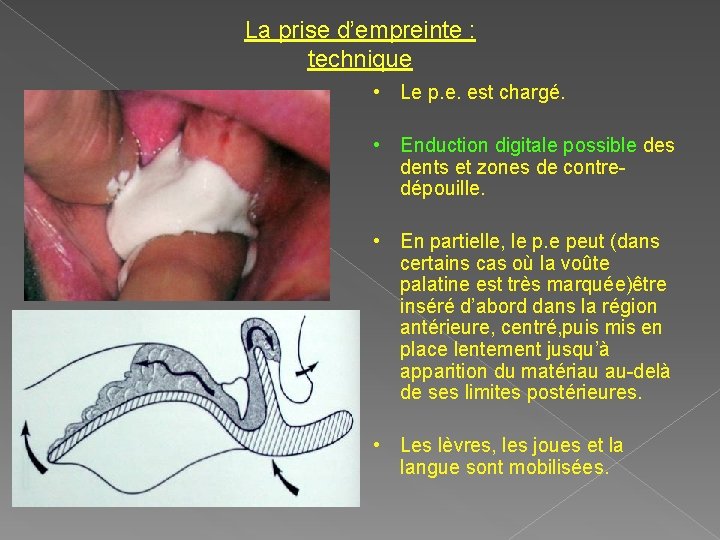 La prise d’empreinte : technique • Le p. e. est chargé. • Enduction digitale