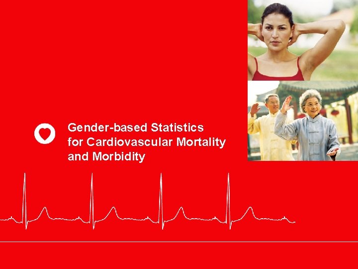 Gender-based Statistics for Cardiovascular Mortality and Morbidity Gender Gap in Management and Outcomes of