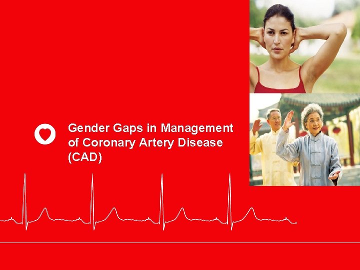Gender Gaps in Management of Coronary Artery Disease (CAD) 