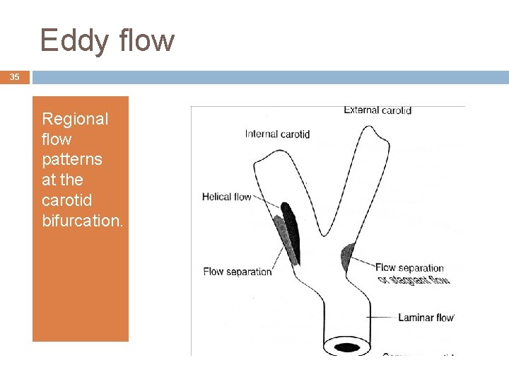 Eddy flow 35 Regional flow patterns at the carotid bifurcation. 