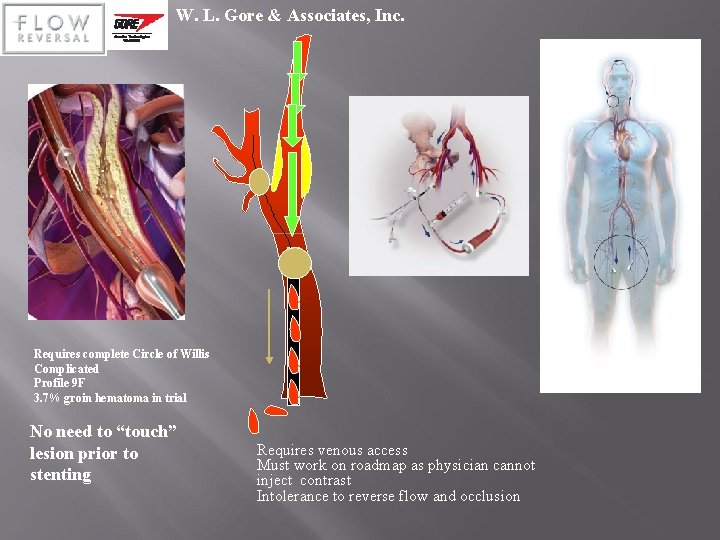 W. L. Gore & Associates, Inc. Requires complete Circle of Willis Complicated Profile 9
