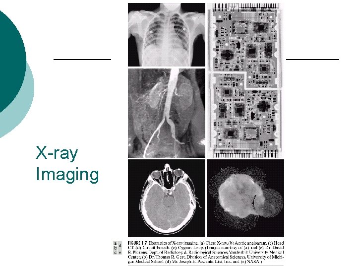 X-ray Imaging 