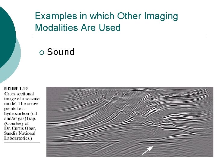 Examples in which Other Imaging Modalities Are Used ¡ Sound 