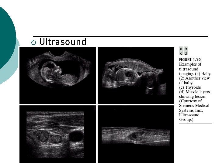 ¡ Ultrasound 